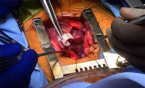 Cirurgia Cardíaca Adulto e Infantil